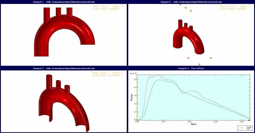 FSI Simulation of Pulsatile Blood Flow in Aortic