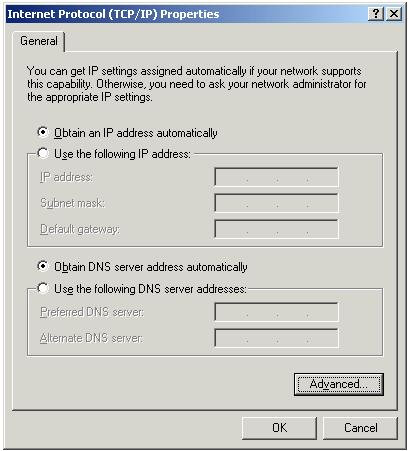 2. Select Obtain an IP address automatically and Obtain DNS server