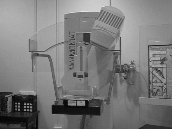 Breast tomosynthesis clinical implementation Parameters: up to 49 projection images up to