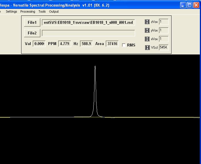 4.5.2 Processing Water-signal (unsuppressed) Spectra Step 1: Click on to start VESPA. Figure 41 Step 2: Click on File 1, browse to a directory that has *.rsd files (binary FID data) and select a *.