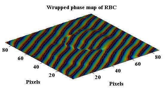 http:// (c) (d) (e) (f) Fig.3.(c) FFT of interferogram. (d) and (e) are wrapped phase map and unwrapped phase map of RBC.Where color bar shows that phase map in radian.