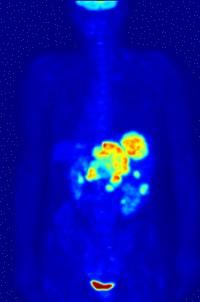 Positron Emission Tomography Nuclear medicine method, used for in-vivo imaging of live tissue Biomolecules, marked with radioactive isotope (eg.