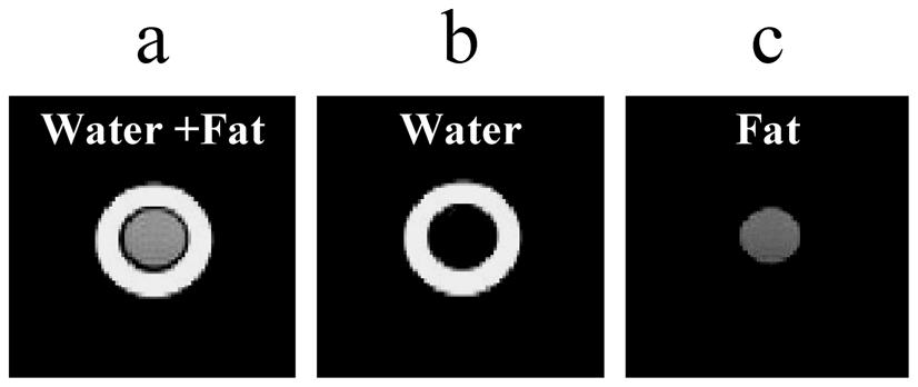 Ababneh et al. Page 18 Fig. 7. a) Unprocessed, b) water-only, and c) fat-only images were obtained from the dataset shown in Fig. 6, using the proposed reconstruction algorithm.