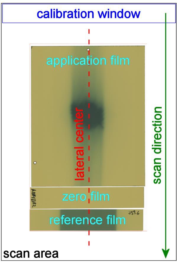 GafChromic Protocol Scanning Procedure Film Positioning on Scanner Highest dose at lateral center Most of exposed areas at lateral center Flatten Film on Scanner Use Glass Plate on top of all films
