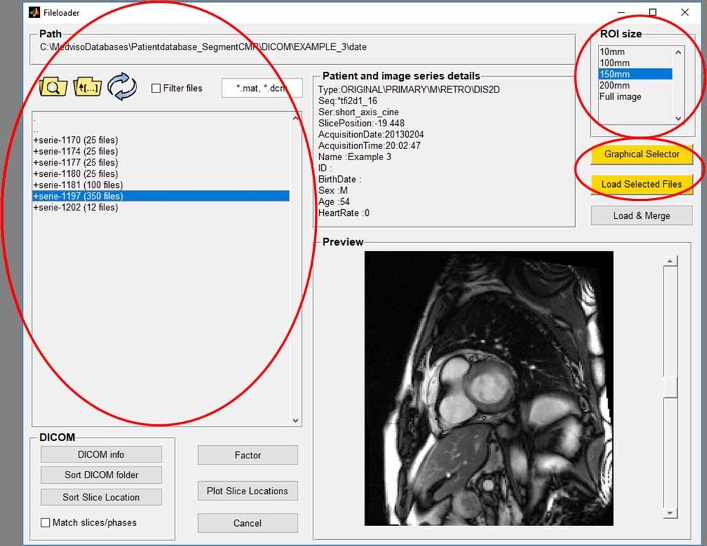 4.2. STORING DATA 2. Enter patient or study details and perform search. 3. Select study and series to load. 4. Load the study into Segment CT by select Open files. 4.1.