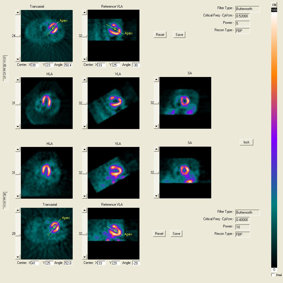 2 36 The Emory Reconstruction Toolbox Application Re-Orienting Images Following reconstruction, a new image screen is displayed for image reorientation (shown in Figure 2-20).