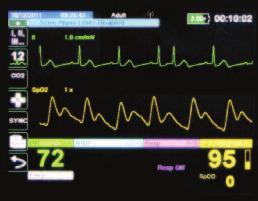 screen or analysis results and real-time ECG simultaneously.