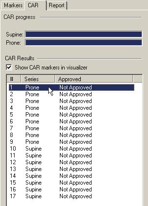 Check Computer Assisted Reporting (CAR) results Click on a marker entry to review the views linked to the marker.