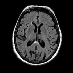 The original and reconstructed images of MRI_Brain, Iris, Mammogram