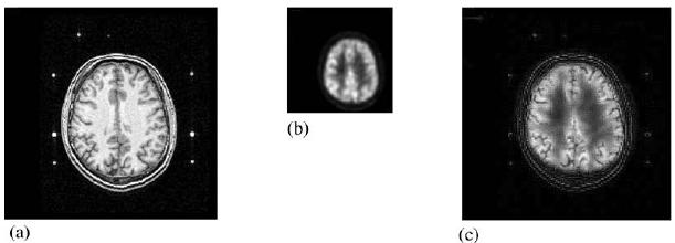 (a) (b) (c) Fig. 6.3. Images with the (a) left and (b) right vehicles out of focus, respectively; (c) resulting fused image by DWT multifocus image fusion scheme using CM and AWA fusion rules. 6.3. Medical image fusion As introduced in Section 1, the PET is a functional image displaying the brain activity, but without anatomical information.