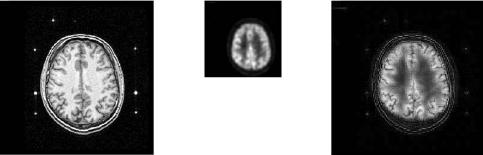 (a) (b) (c) Fig. 1.4. (a) MRI and (b) PET images; (c) fused image from (a) and (b). 1.2. Image fusion methods There are various methods that have been developed to perform image fusion.
