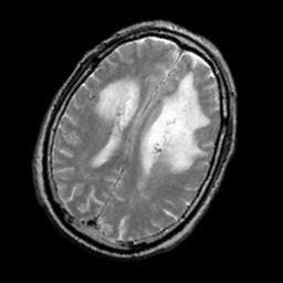 experiments consists of 66 T2-weighted MR brain images in axial plane, free from common MRI artifacts (downloaded
