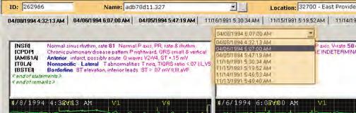 Viewing and Editing Reports 2 To select the second ECG to display, click the ECG dropdown list above the comparison ECG.