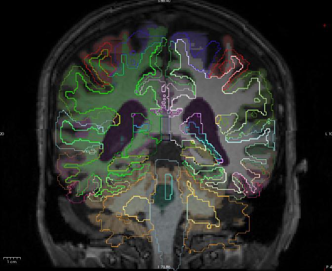 visible in fmri 2.