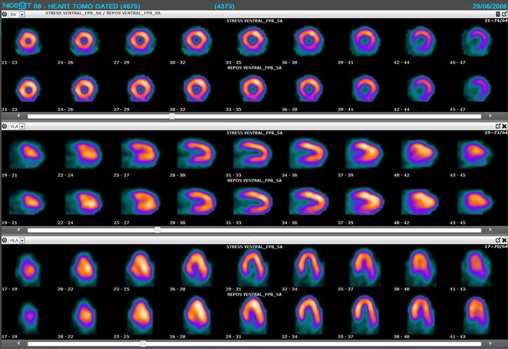 VenusCardiac Clinical application for reconstruction, processing and display of gated and ungated tomographic cardiac data.
