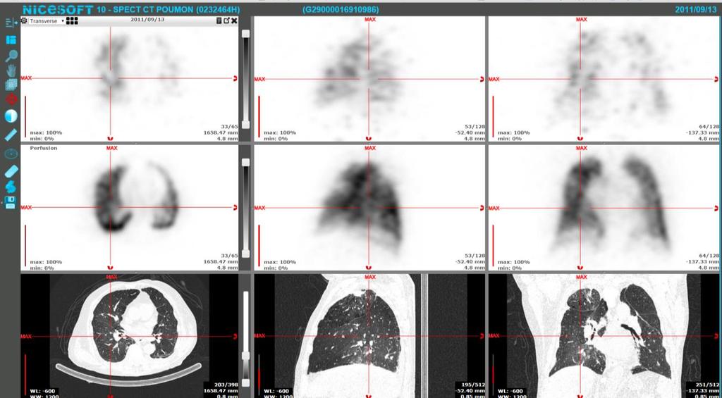 LungSPECT-CT An application for reconstruction, display