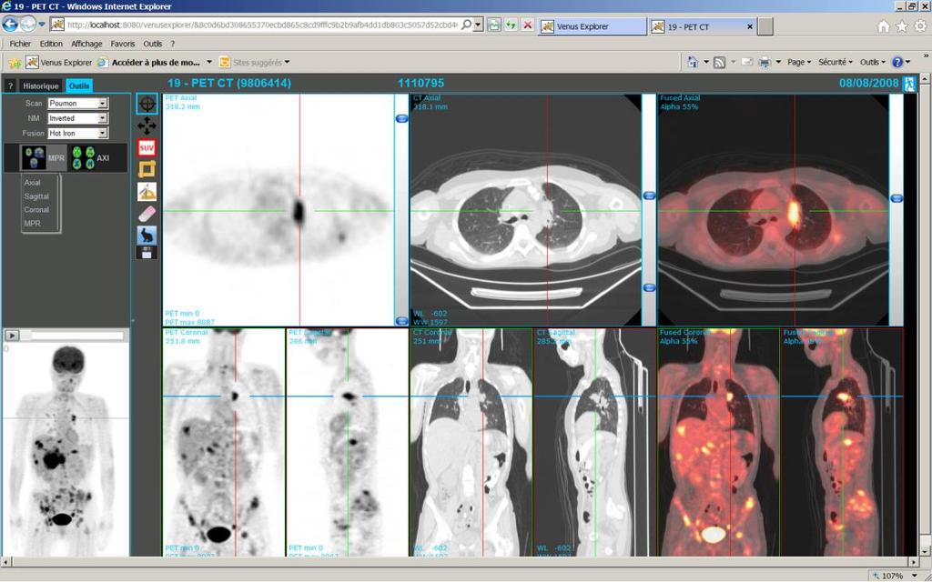 PET-CT-Onco (multimodality viewing) Clinical application for review and analysis of PET/CT studies.