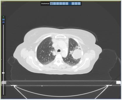 Gated Data RTx supports the display of gated CT, PET, Planar NM and SPECT. Multiple time points of gated data are supported.