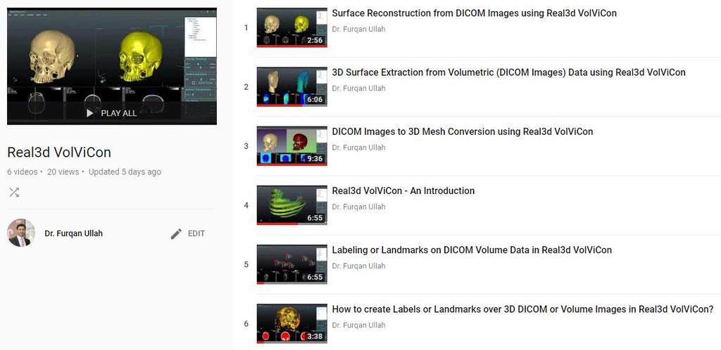 1. Videos Many videos and tutorials of VolViCon are uploaded to the YouTube channel. Please visit YouTube channel for more details. https://www.youtube.