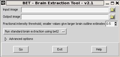 Brain extraction In practice: Brain