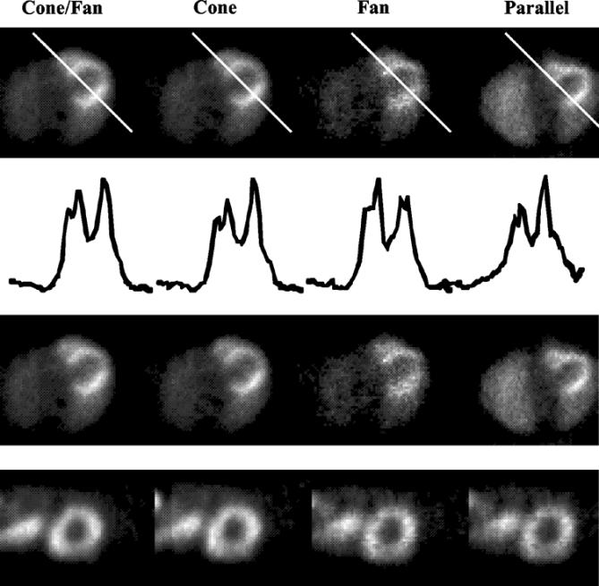 The next row is the same set of images as the top row but without the line fiducial. The bottom row shows short axis views zoomed to focus more on the heart itself.