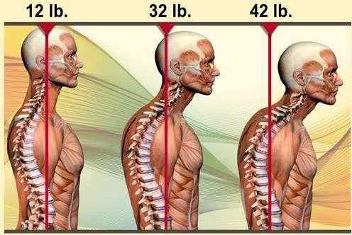 Figure 2: Relative Weight of the Head Over the Body [4] As an individual s COM is shifted out of line, the head is one part of the body that can cause additional stresses on the rest of the body.