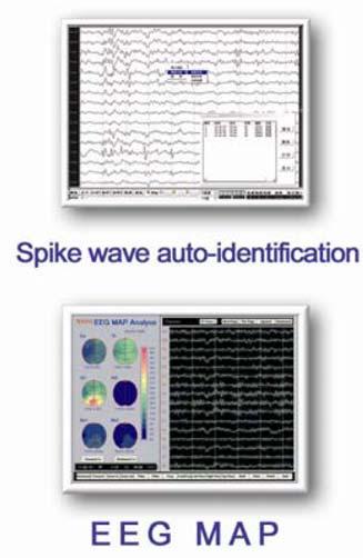 Event marking function, reviewing and analysis of dynamic EEG waveform and artifact are provided Printing: Tool for