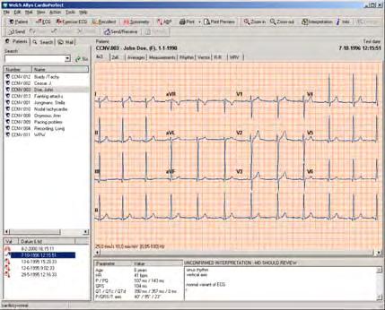 View Parameters Interpretation 4.1. View and edit ECG information The Information window gives you all kinds of information about the ECG that you are currently viewing.