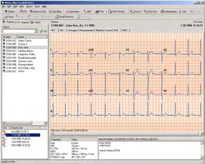 1. Getting started 1.1. The Welch Allyn CardioPerfect resting ECG window This section will guide you around the various parts of Welch Allyn CardioPerfect Resting ECG module.