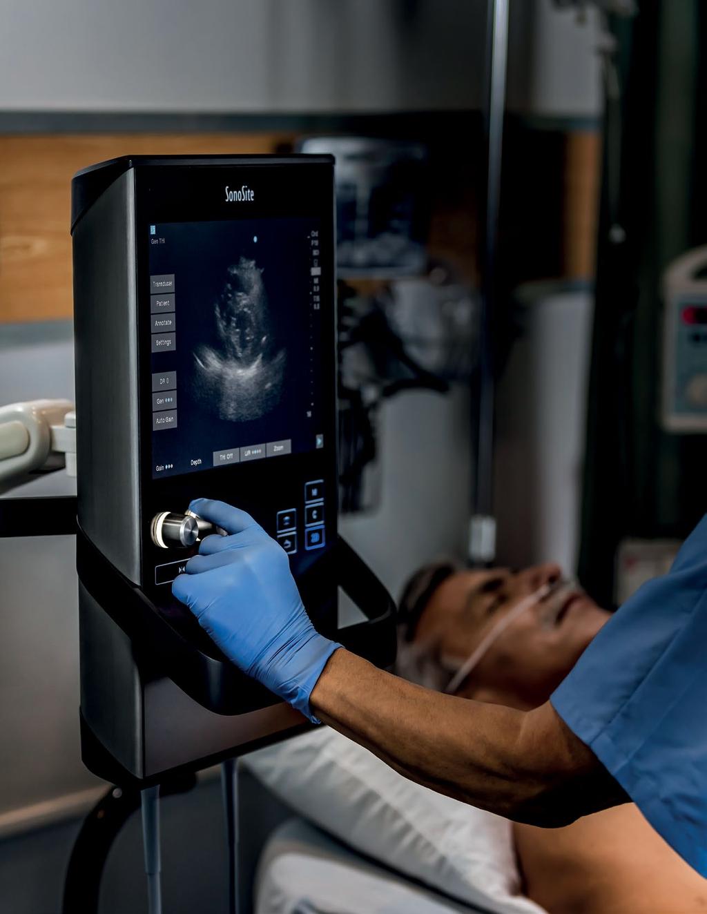 TRANSFORMING THE PACE OF YOUR PRACTICE, THROUGH SIMPLY, SMART ULTRASOUND. The SII empowers your efficiency through an intuitive, yet smart user interface that adapts to your imaging needs.