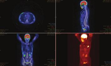 A wide range of function-specialized toolboxes provide a well-detailed, fast and easy evaluation of medical images combining with advanced visualizations