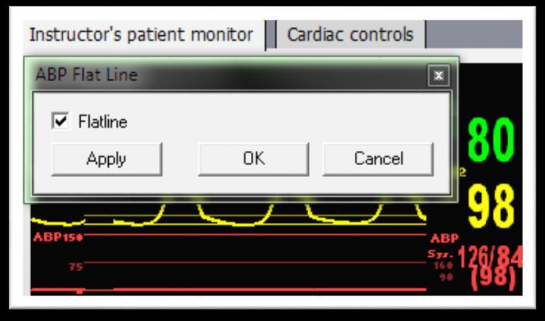 Refer to your patient monitor's documentation for procedures of zeroing the pressures within the monitor's user interface.