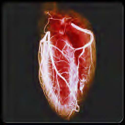 4.1 Compression of image heart.jpg The heart.