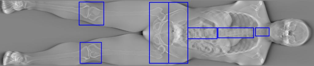Towards full-body X-ray images 3 Fig. 2. Central slice of a tomosynthetic reconstruction. The ROIs are outlined in blue.