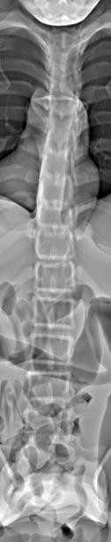 5, the standard synthetic radiograph suffers from overlapping structures and the state-of-the-art full-body radiograph approach from overlapping structures and distortion and magnification.
