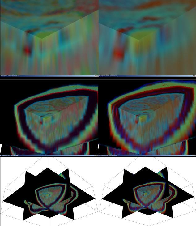 A D B E F Figure 8. Three-dimensional visualization of 3-band fusion results. Left column presents results obtained using the new 3D shunting operator.