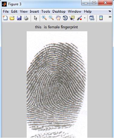 The result of the gender classification of 400 male and 400 female fingerprints is shown in Fig.12. The success rate for female fingerprints is 65.25% 