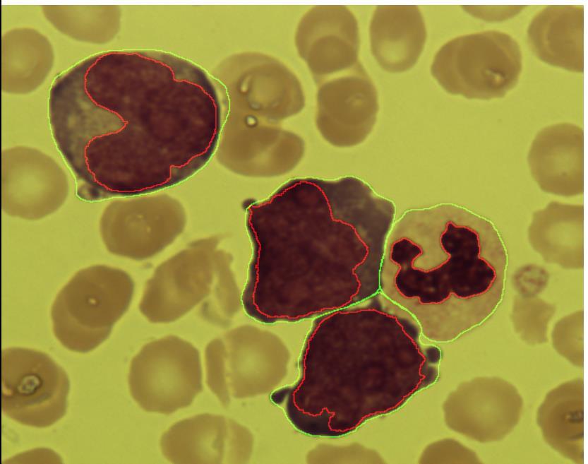 Example: Segmentation of leukocytes in stained smears of peripheral blood.