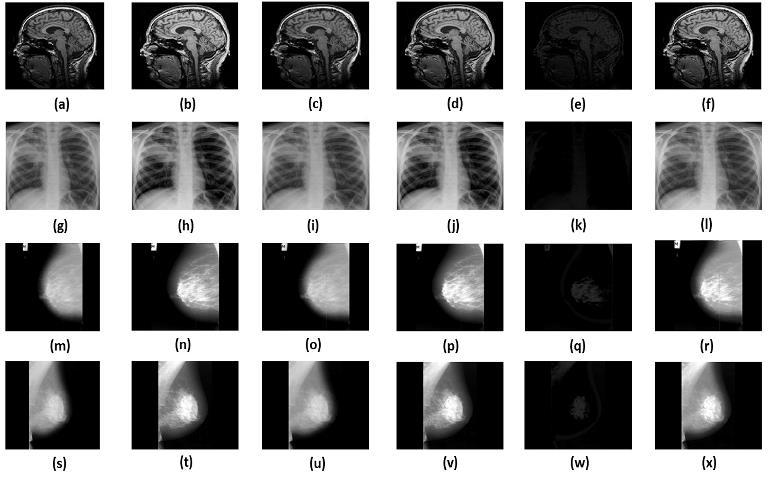 image of (brain_mri, Ribs X-Ray, mdb013, mdb212). The enhancement provided by SIDCSIHE method as shown in Fig.