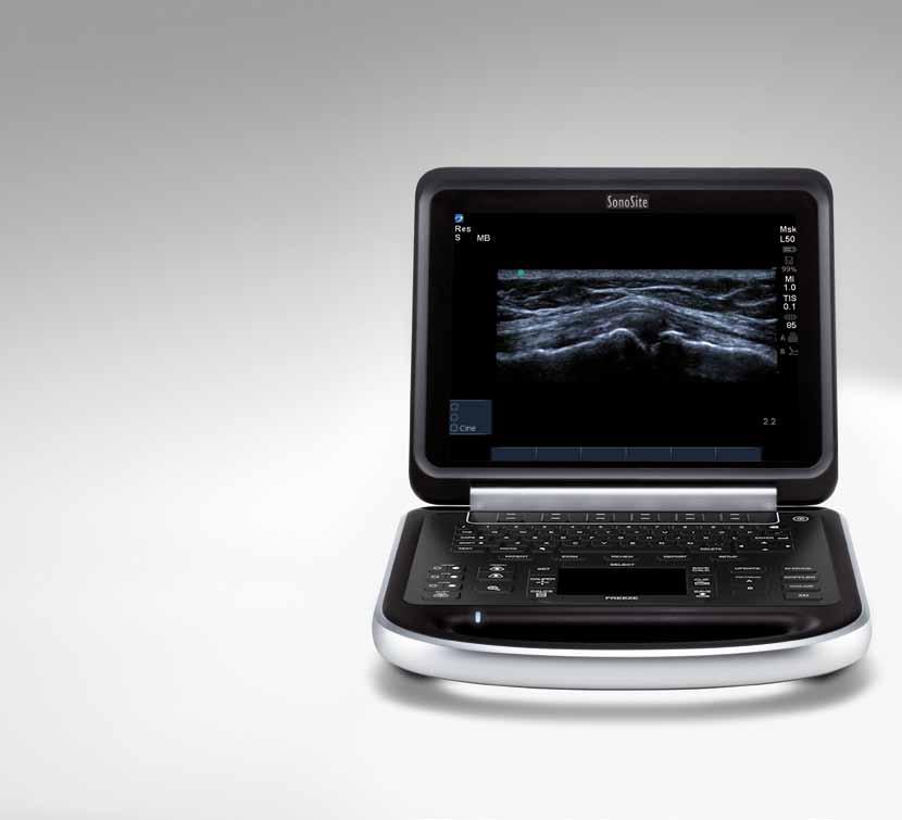 Designed for the point of care 30.7 cm/12.1" LCD monitor Large clinical image area PC- and Mac-friendly for effortless data management with 2 high-speed USB 2.0 ports 3.85 kg/8.5 lbs.
