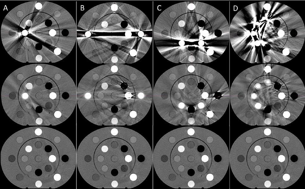 CT number accuracy with MAR Evaluation of a prototype algorithm using a phantom with 25mm steel inserts: W/o MAR With MAR Phantom w/o metal From: Axente