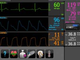 EKG monitoring 12 lead EKG recording Invasive Blood