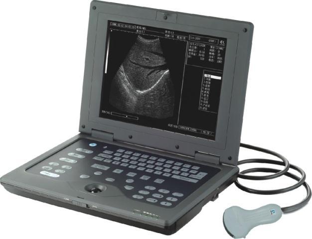 rate, EF slope, pregnant week, fetal weight and EDCB Image displayed with comments of date, time, scanning depth, probe type, parameter of frame correlation, focus combination, patient ID, age, sex,