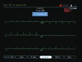 It s the same technology that s found throughout our family of premier ECG analysis systems, providing you with consistent measurement and interpretation.