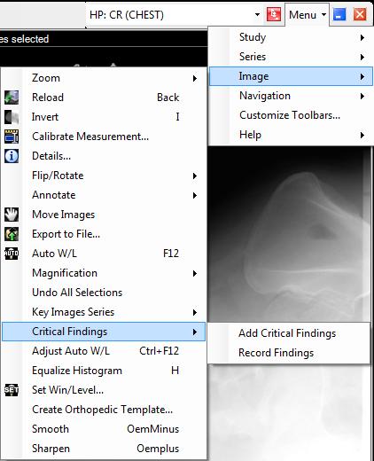 Critical Findings Critical Findings allows for a quick and easy way for radiologists to mark images, series, and studies with any critical finding or value that might be necessary to report on.