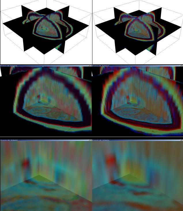 A D B E F Figure 8. Three-dimensional visualization of 3-band fusion results. Left column presents results obtained using the new 3D shunting operator.