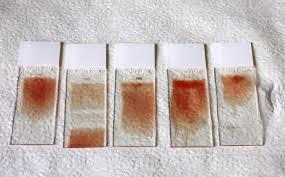 Aim: Blood Smear Preparation To identify the blood cell types in human blood smear.