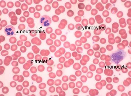 6. Observe as many different types of blood cells as possible. Pay close attention to size, frequency, and nuclear features. Observation: Different types of blood cells are visible (Neutrophil.
