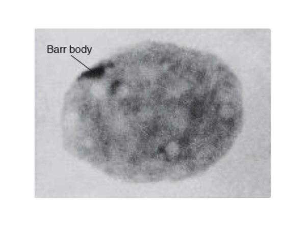 Principle: Buccal epithelial cells especially have Barr body structure, which are considered to play a major role for sex determination.