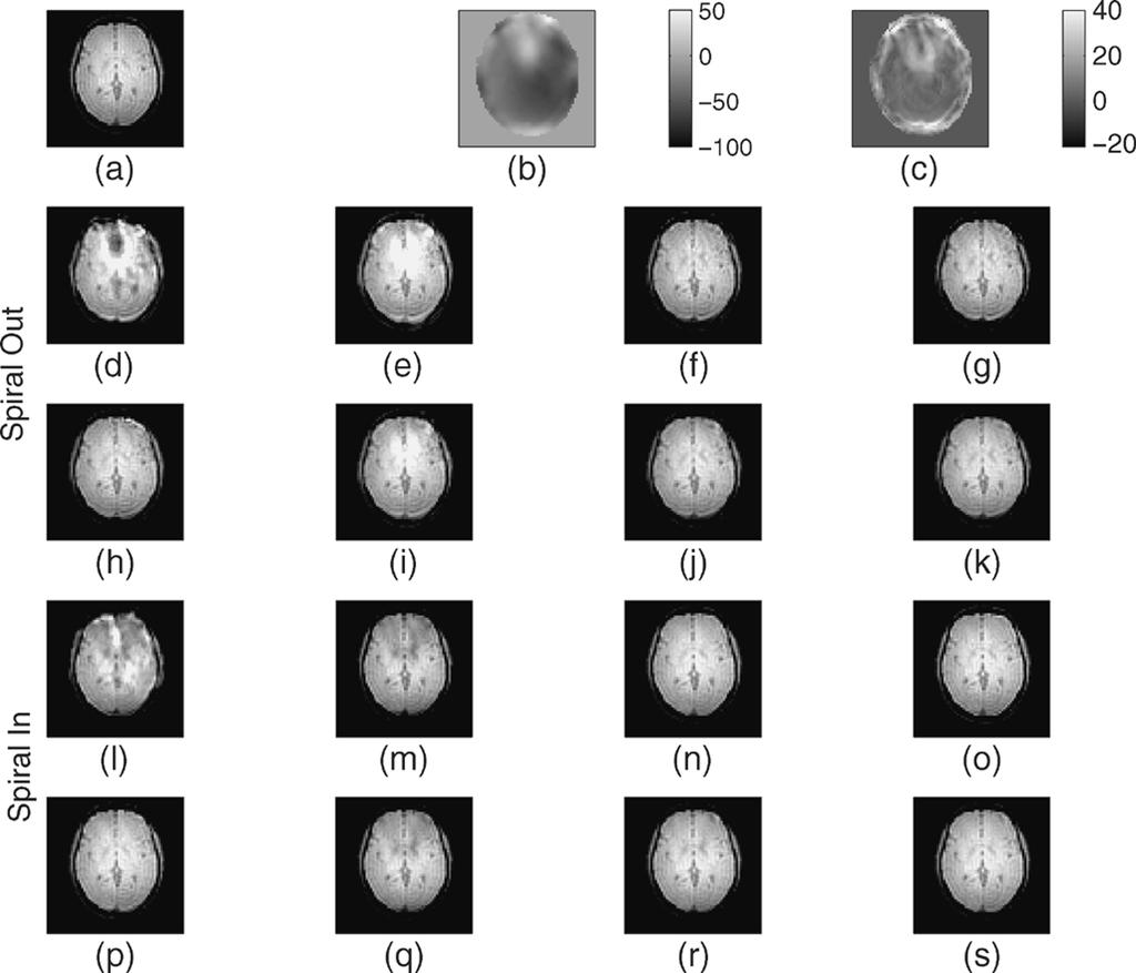 332 IEEE TRANSACTIONS ON MEDICAL IMAGING, VOL. 24, NO. 3, MARCH 2005 Fig. 4. Simulation of a spiral acquisition for case of homogeneous field in (a).